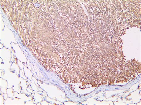 Treponema Pallidum Antibody (RPab) - Bio SB
