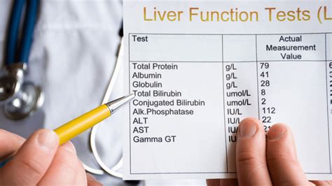 Simplifying Blood Tests for Covid
