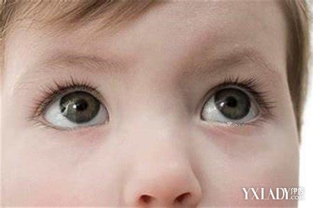 【图】2岁宝宝眼睛有黑点怎么办 专家分享正确诊治方法(2)_伊秀美容网|yxlady.com