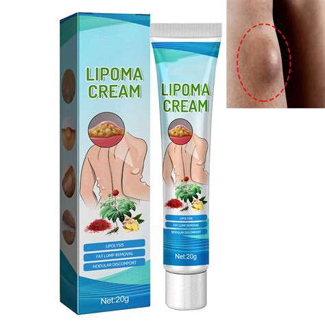 Lipoma Care Cream Lipoma Removal Cream Lipoma Elimination Cream Lipoma Creams Lump Free Cream ...