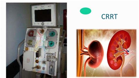 CRRT Recirculation 的图像结果
