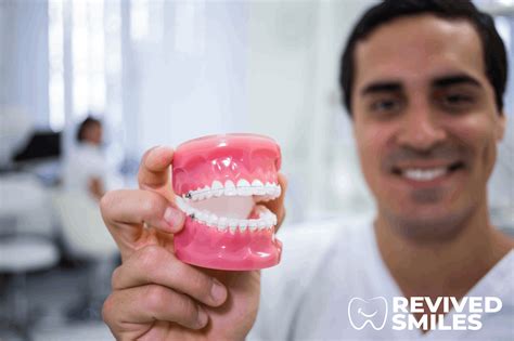 Image result for Different Types Dentures