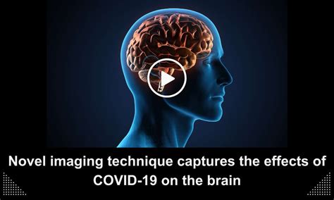 Novel imaging technique captures the effects of COVID-19 on the brain