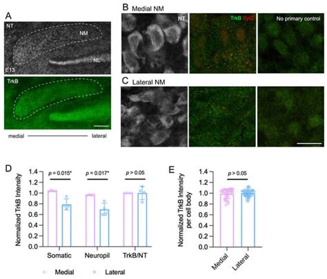 BDNF Differentially Affects Low- and High-Frequency Neurons in a ...