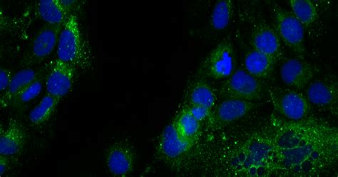 Image result for Biological Image Analysis Using R