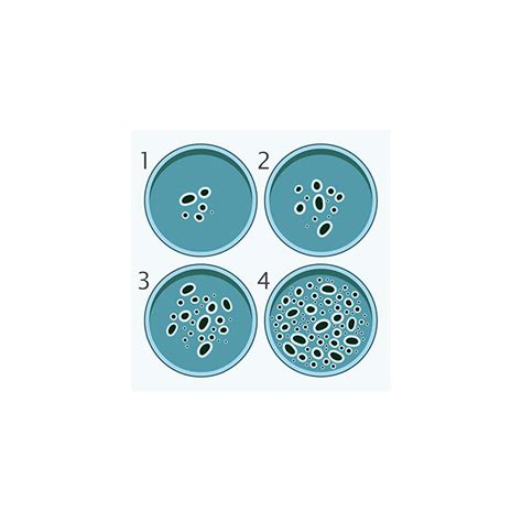 Buy Onnetila Bacteria Science Kit Petri Dishes with Agar Educational ...