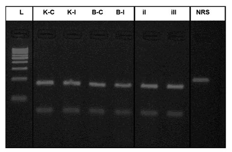Transposable Elements in the Revealing of Polymorphism-Based ...