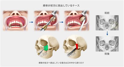 Image result for Spatial Memory Localization