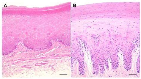 Comparative Study of the Gastric Mucosa of Risso’s Dolphin (Grampus ...