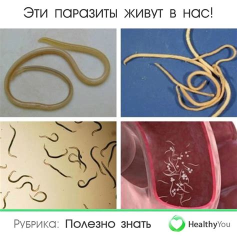 Глисты у грудничка: симптомы, причины и лечение