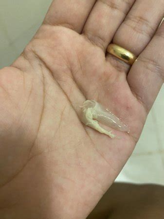 Clumpy Discharge 的图像结果