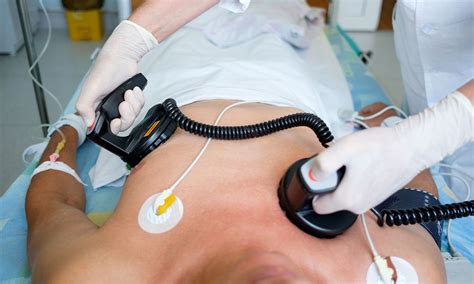 Image result for Cardioversion Procedure Note Template