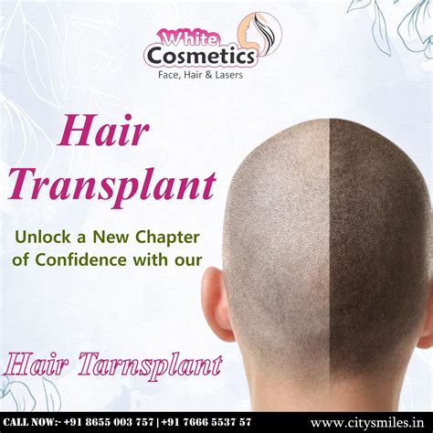 Unlock a new chapter of confidence with White Cosmetics! | City Smiles ...