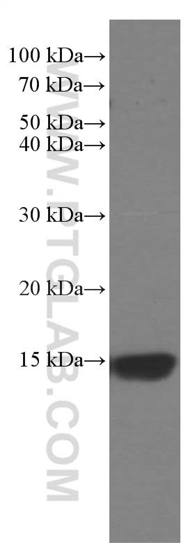 RBX1 antibody (66716-1-Ig) | Proteintech
