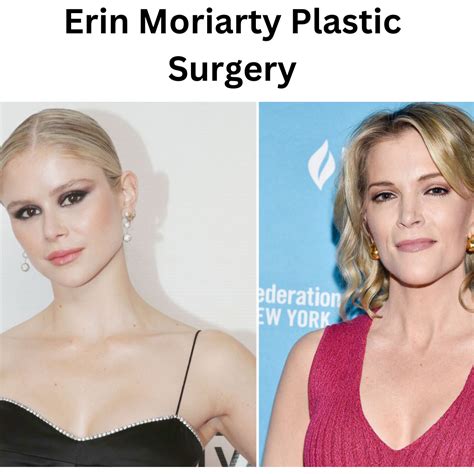 The Truth Behind Erin Moriarty Plastic Surgery Rumors - Celebrity ...