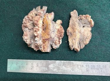 ACHR - IP Arch Cytol Histopathol Res