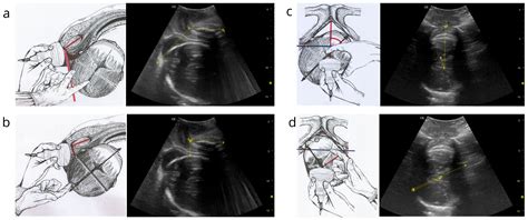 Artificial Intelligence Dystocia Algorithm (AIDA) for Risk ...