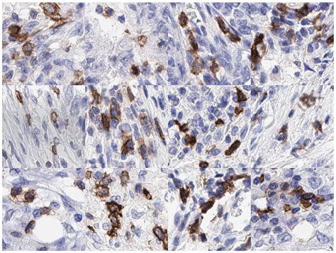 ICOSeg: Real-Time ICOS Protein Expression Segmentation from ...