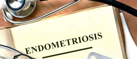 Endometriosis: Symptoms, Effects, and Treatment Options Dr. DEEPAK ...