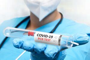 RT-PCR Test Procedure 的图像结果