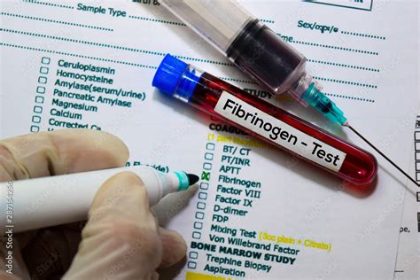 Image result for Fibrinogen Test Procedure