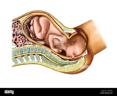 Illustration of childbirth. Second stage: Expulsion of the foetus phase ...