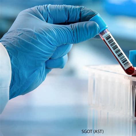 AST Blood Test 的图像结果