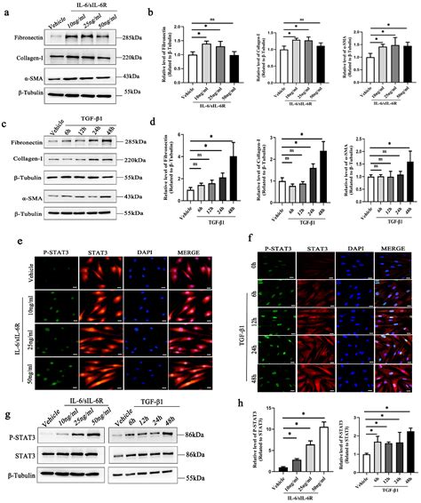 The Role of STAT3 Signaling Pathway Activation in Subconjunctival Scar ...