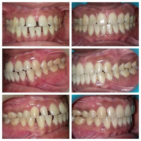 Gallery - PROFILE ORTHODONTICS & COSMETIC DENTISTRY