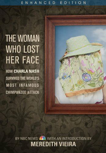 The Woman Who Lost Her Face (Enhanced Edition): How Charla Nash ...