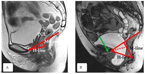 Diagnostic Value of Dynamic Magnetic Resonance Imaging (dMRI) of the ...