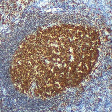 BOB-1/OBF-1 - PRM126 | Pathnsitu Biotechnologies
