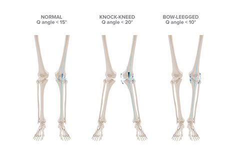 Q Angle Genu Valgum Valgus Definition And Examples Biology Online