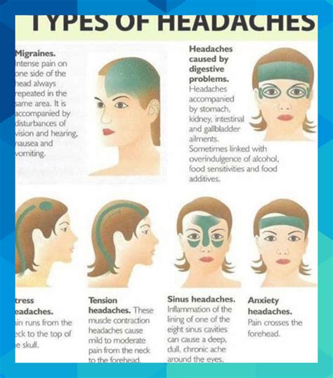 Eyes Pain And Headache Reason at Brent Skinner blog