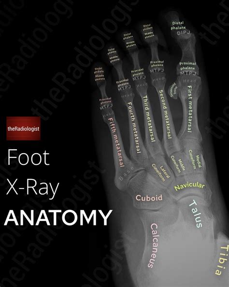 Foot and Ankle X-Ray Guide – the Radiologist
