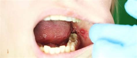 Oral Health: Causes, Tips & Treatments