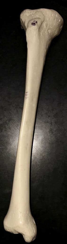 Image result for Ribstride Tibia