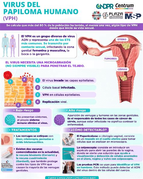 Enfermedades De Transmision Sexualidad Papiloma Humano Enfermedades De
