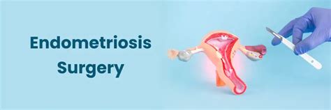 Endometriosis Surgery: Types, Benefits,& Recovery process