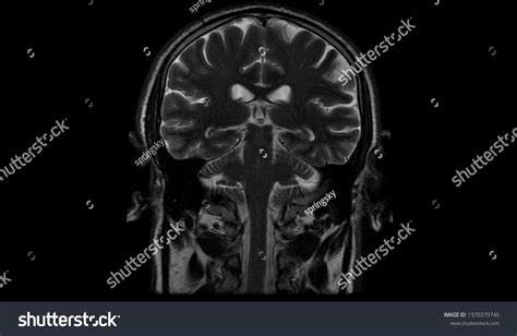 High Res Brain Scan Image 的图像结果