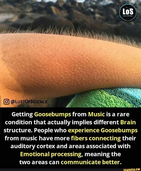 Los Getting Goosebumps from Music is a rare condition that actually ...