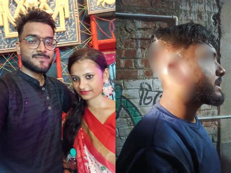 young man attacked at girlfriend house eye injury police intervene ...