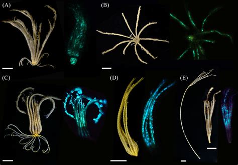 Crinoidea Sea Lilies Anatomy