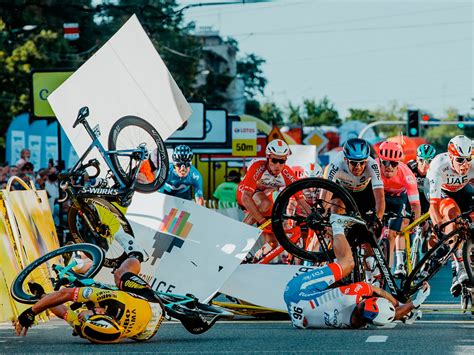 Fabio Hit In Face With