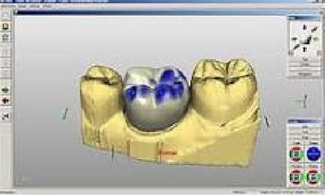 Best ENT & Dental clinic in Surat | Aurora Clinic – Expert Dental Care ...