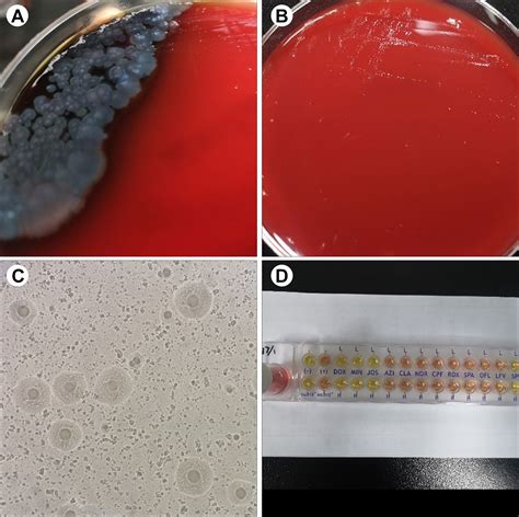 Mycoplasma Pneumoniae Colonies