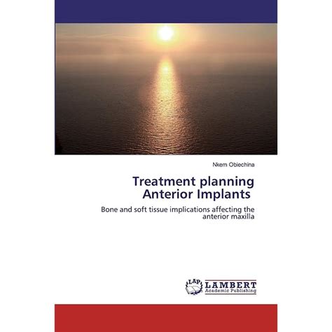 Buy Treatment planning Anterior Implants: Bone and soft tissue ...