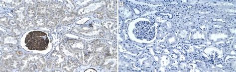 Anti-Podocalyxin Antibody, clone 1E13 ZooMAb® Rabbit Monoclonal ...
