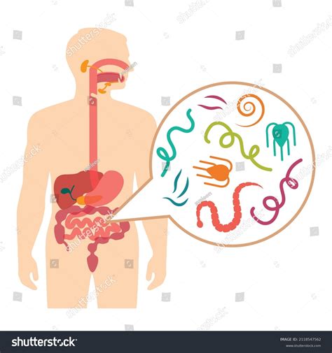 Worms In Humans Stomach