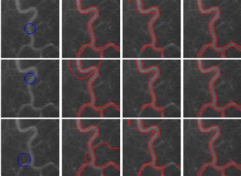 Image result for Normal Blood Segmenter Values